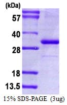 Human CD274 / B7-H1 / PD-L1 Protein (Recombinant His)