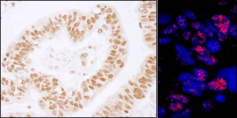 Polyclonal Rabbit anti-Human PLRG1 Antibody (aa464-514, IHC, IF, WB)
