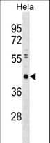 Polyclonal Rabbit anti-Human CBX8 Antibody (aa306-337, IHC, WB)