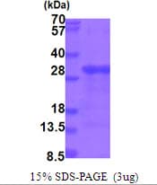 Human HBP17 / FGFBP1 Protein (Recombinant His)