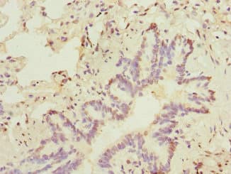 Polyclonal Rabbit anti-Human SOX5 Antibody (IHC)
