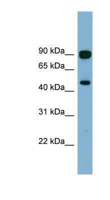 AGK Antibody (aa107-156)