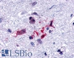 PathPlus™ GPR44 / CRTH2 Antibody (Extracellular Domain)