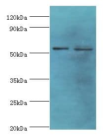 PNPLA2 / ATGL Antibody (aa265-504)
