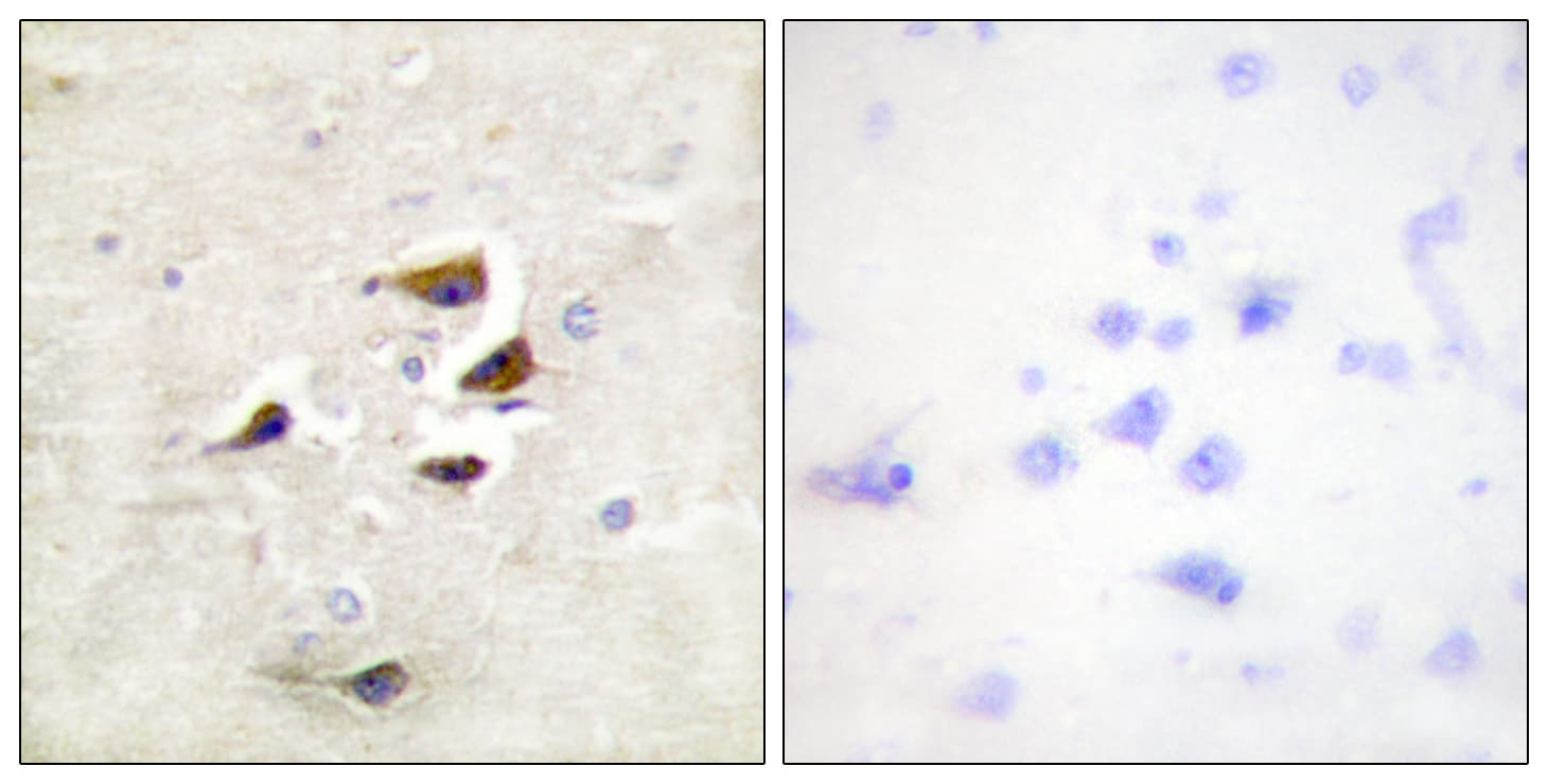 CaMKII Alpha+Beta+Delta Antibody (Internal)
