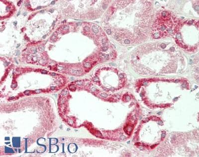 IHC-plus™ TSPO / PBR Antibody (C-Terminus)