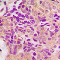 MRPS21 Antibody (Internal)