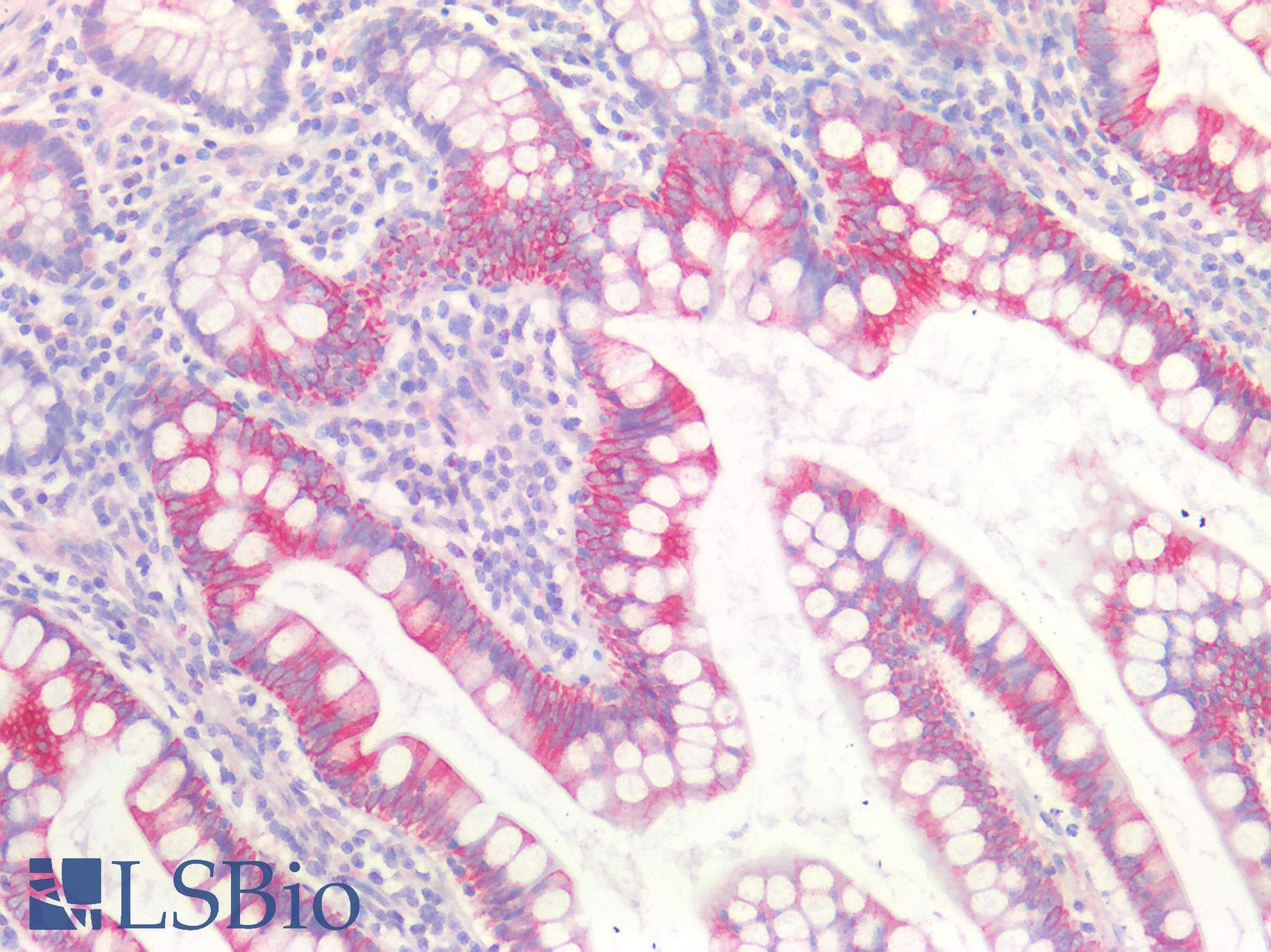 PathPlus™ Polyclonal Rabbit anti-Human UCHL1 / PGP9.5 Antibody (IHC)