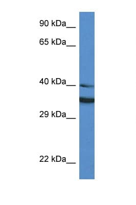 Polyclonal Rabbit anti-Human NQO1 Antibody (aa111-160, WB)