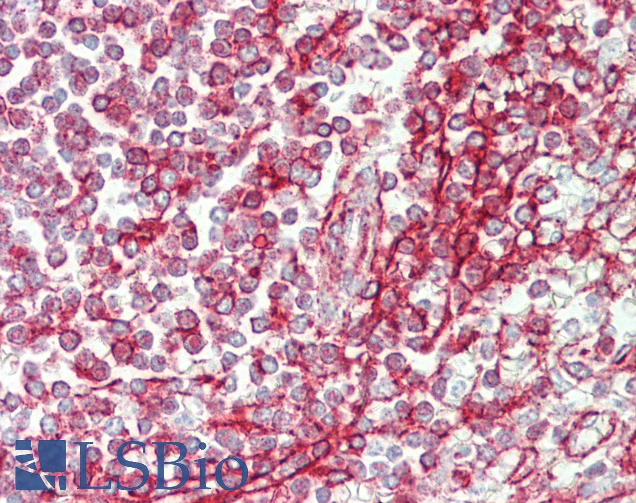 IHC-plus™ Polyclonal Rabbit anti-Human NCOA3 / SRC-3 / AIB1 Antibody (IHC, WB)