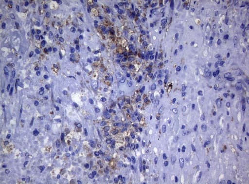 CTSL / Cathepsin L Antibody (clone OTI6B8)