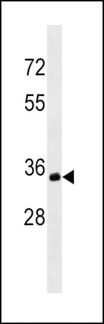 CD20 Antibody (aa266-294)