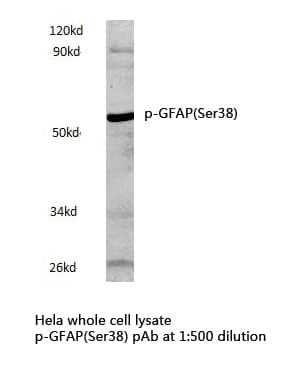 Polyclonal Rabbit anti-Human GFAP Antibody (phospho-Ser38, WB)