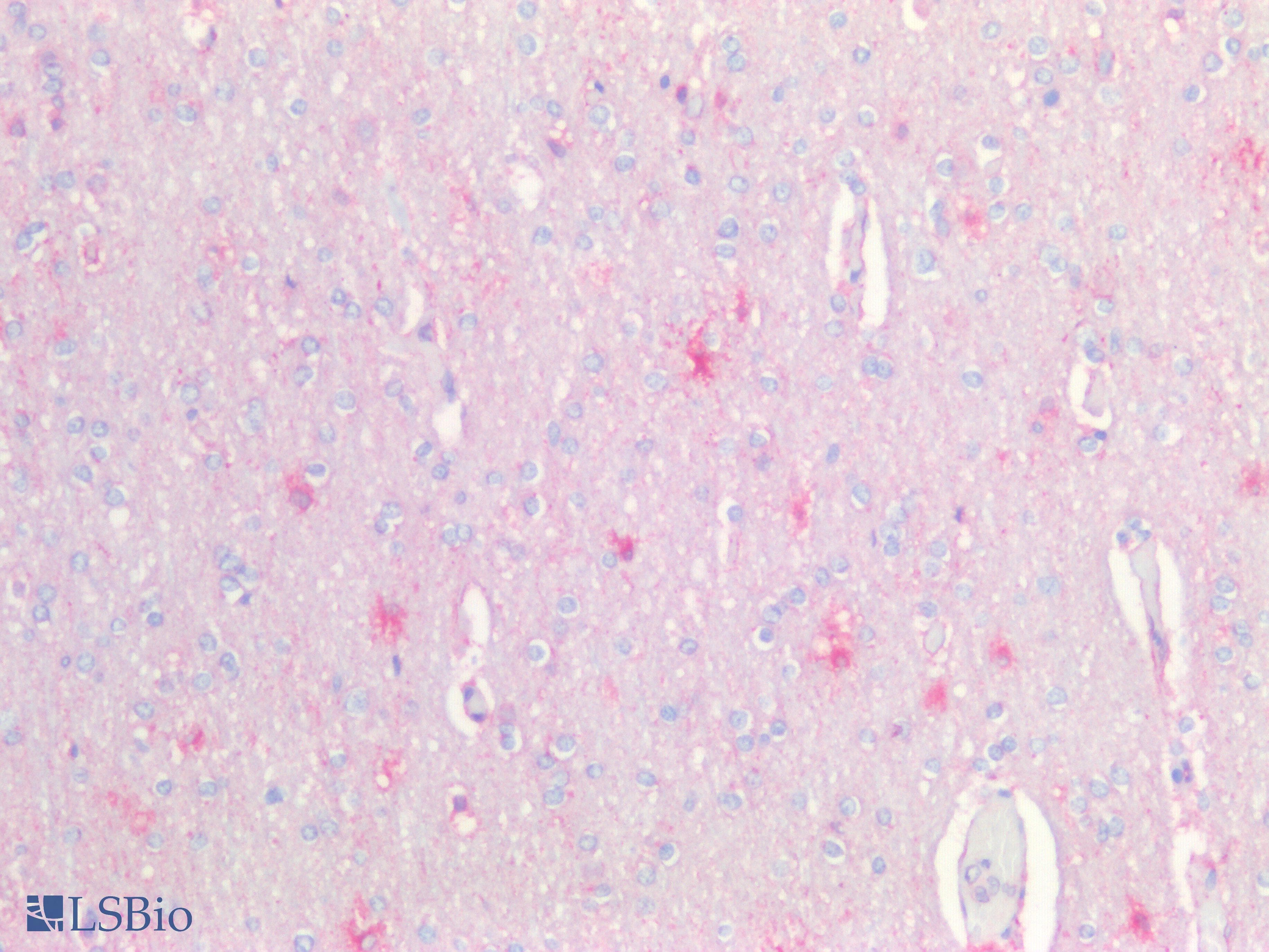 IHC-plus™ NCAM / CD56 Antibody (aa353-366)