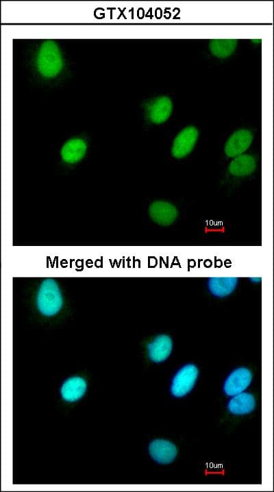 RFC4 Antibody (aa18-323)