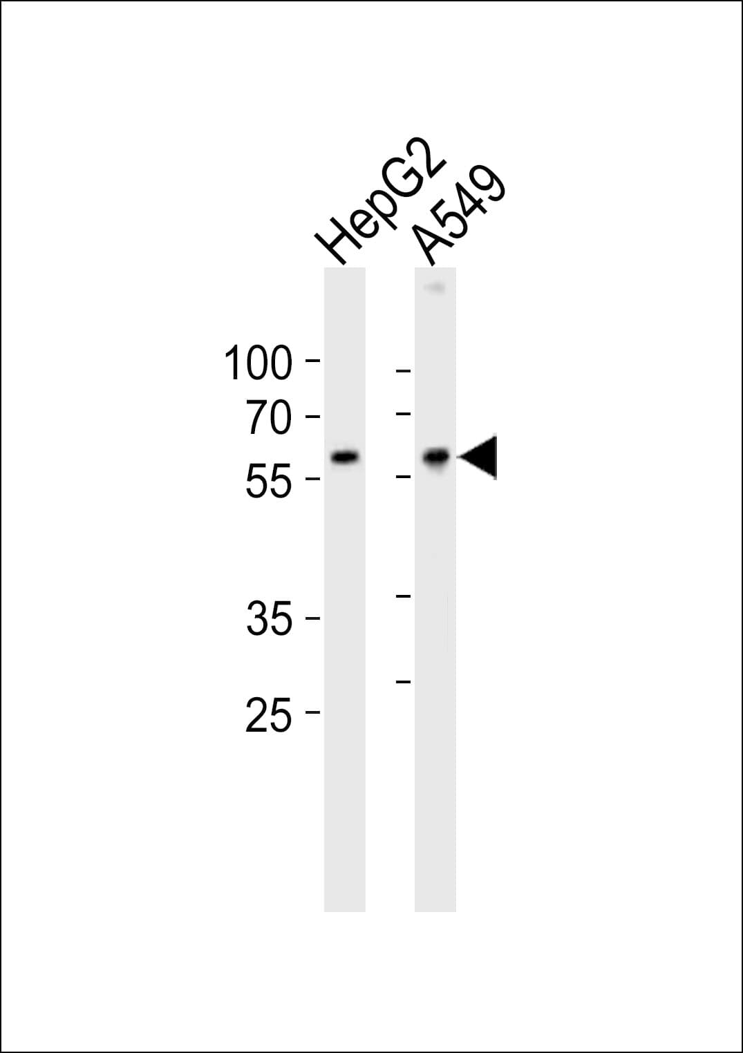 Polyclonal Rabbit anti-Human USP22 Antibody (aa351-380, IHC, WB)