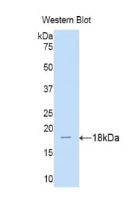 IL17RA Antibody (aa33-172, Cy3)