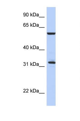 Polyclonal Rabbit anti-Human CDC34 Antibody (C-Terminus, WB)