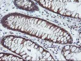 PYCARD / ASC / TMS1 Antibody (clone OTI2A7)