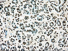TYRO3 Antibody (clone OTI4C8)