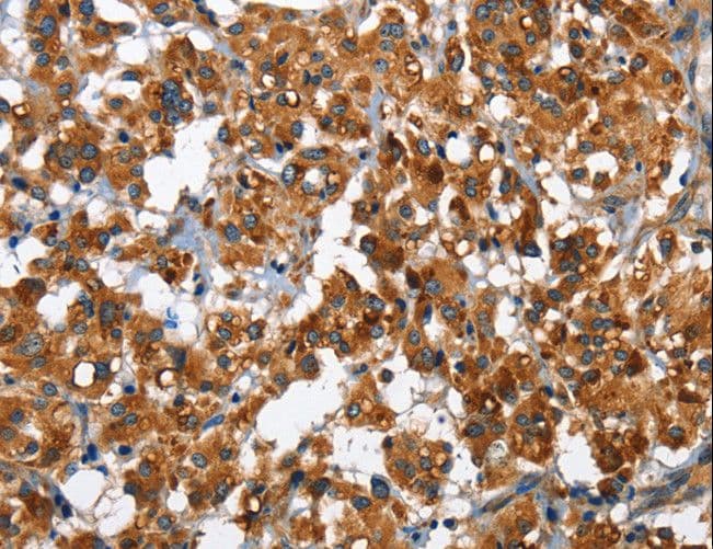 SLAMF8 Antibody