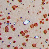 FBLN4 / EFEMP2 Antibody (Internal)