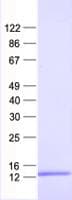 Human RPL31 / Ribosomal Protein L31 (Recombinant His, N-Terminal)