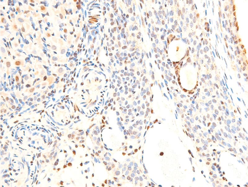 ERBB2 / HER2 Antibody (phospho-Tyr1248)