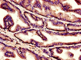 C1QG / Complement C1QC Antibody