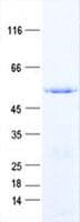 Human ALS2 / Alsin Protein (Recombinant His, N-Terminal)