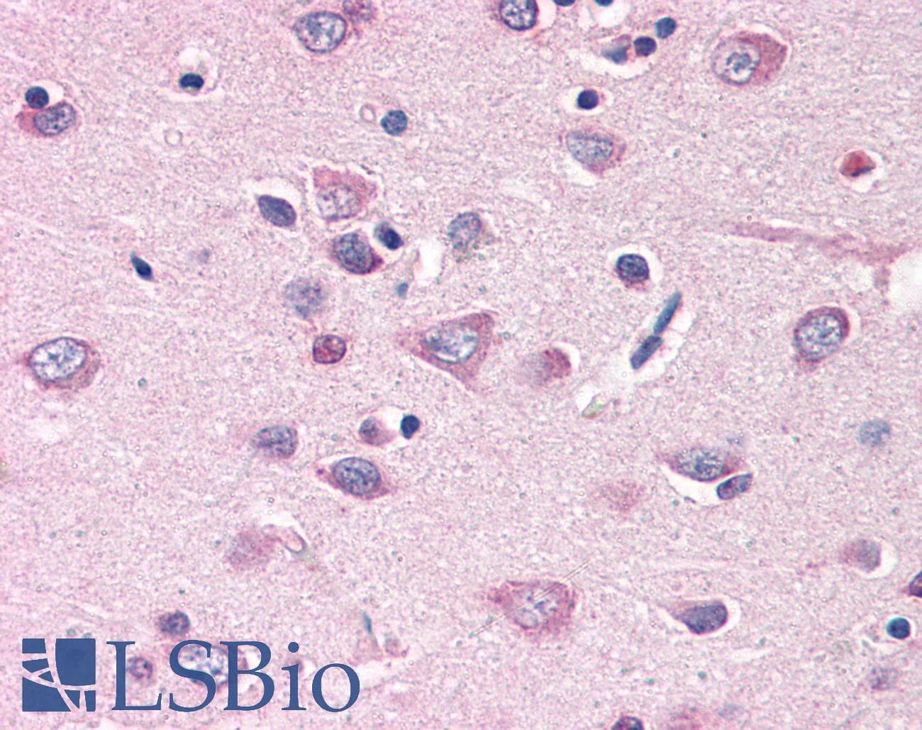 IHC-plus™ Polyclonal Rabbit anti-Human MFI2 / p97 Antibody (N-Terminus)