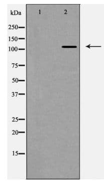 Polyclonal Rabbit anti-Human ITGAV/Integrin Alpha V/CD51 Antibody (IHC, WB)