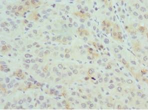 PSME1 Antibody