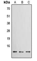 Polyclonal Rabbit anti-Human PROK1 / EG-VEGF Antibody (Internal, WB)