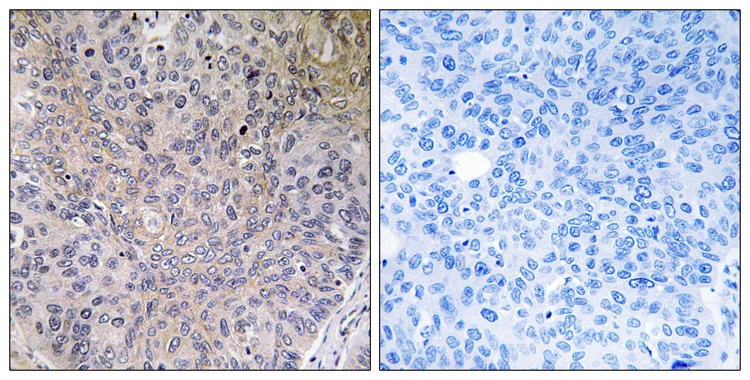 NDUFS7 Antibody