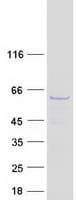 Human CDC73 / Parafibromin Protein (Recombinant Myc-DDK (Flag))
