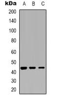 CTSD / Cathepsin D Antibody (Internal)