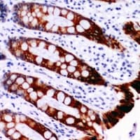 SMAD3 Antibody