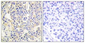 Polyclonal Rabbit anti-Human PRKCQ / PKC-Theta Antibody (phospho-Ser695, IHC, WB)