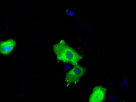 BTK Antibody (clone OTI15G8)