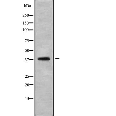 Leukotriene B4 Receptor / BLT1 Antibody