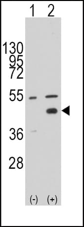 IHC-plus™ WIF1 Antibody (aa51-80)