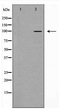 CTNNA1 / Catenin Alpha-1 Antibody