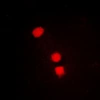 SMCHD1 Antibody