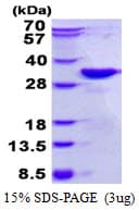 Human DKK2 Protein (Recombinant His)