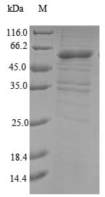 Human MKRN3 Protein (Recombinant 10His, N-terminus + Myc, C-terminus)