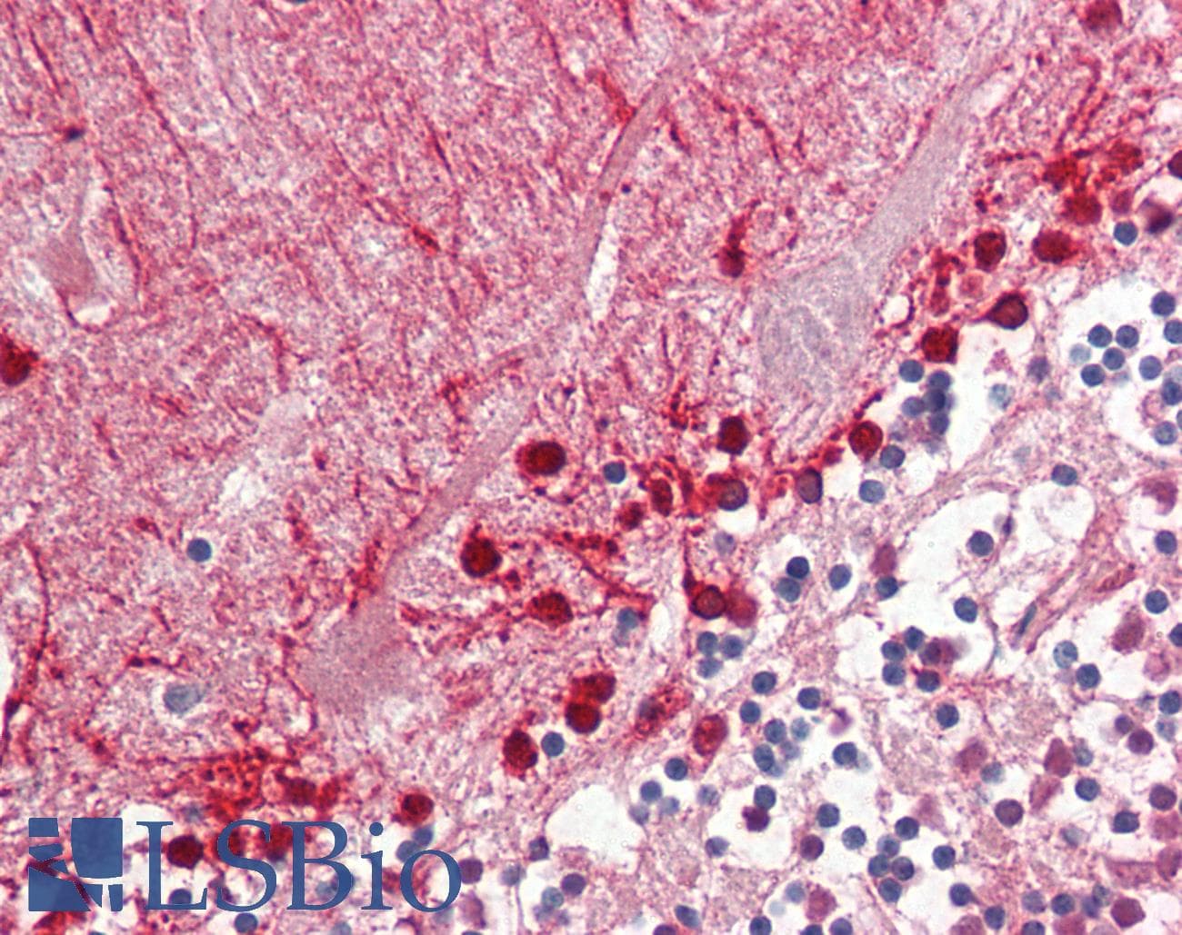 IHC-plus™ Polyclonal Goat anti-Human ALDH9A1 Antibody (aa297-311, IHC, WB)