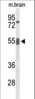 GRB7 Antibody (aa289-318)