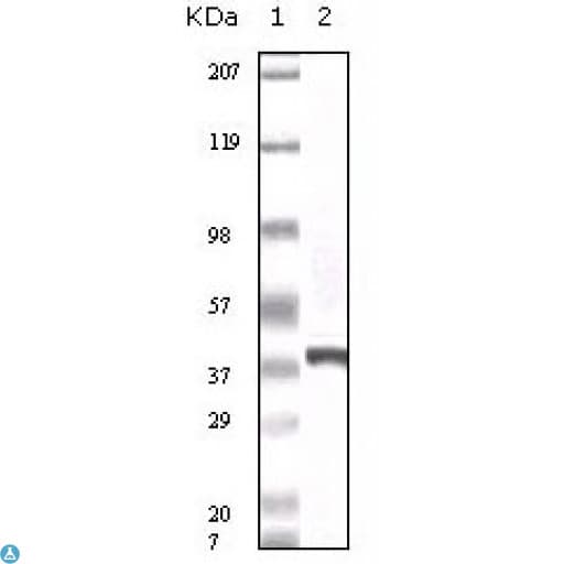 S100A6 / Calcyclin Antibody