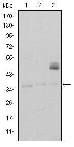 Monoclonal Mouse anti-Human CD1A Antibody (clone 7A7, IHC, IF, WB)